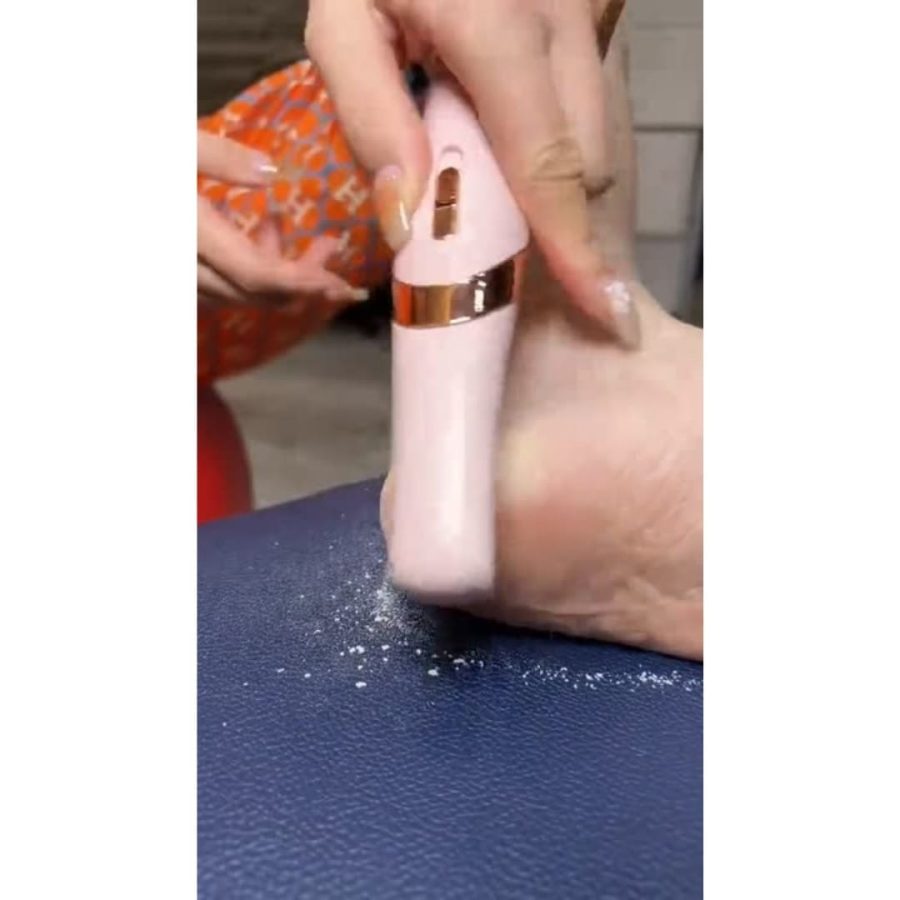 Rechargeable Electric Foot File Callus Remover — photo 4