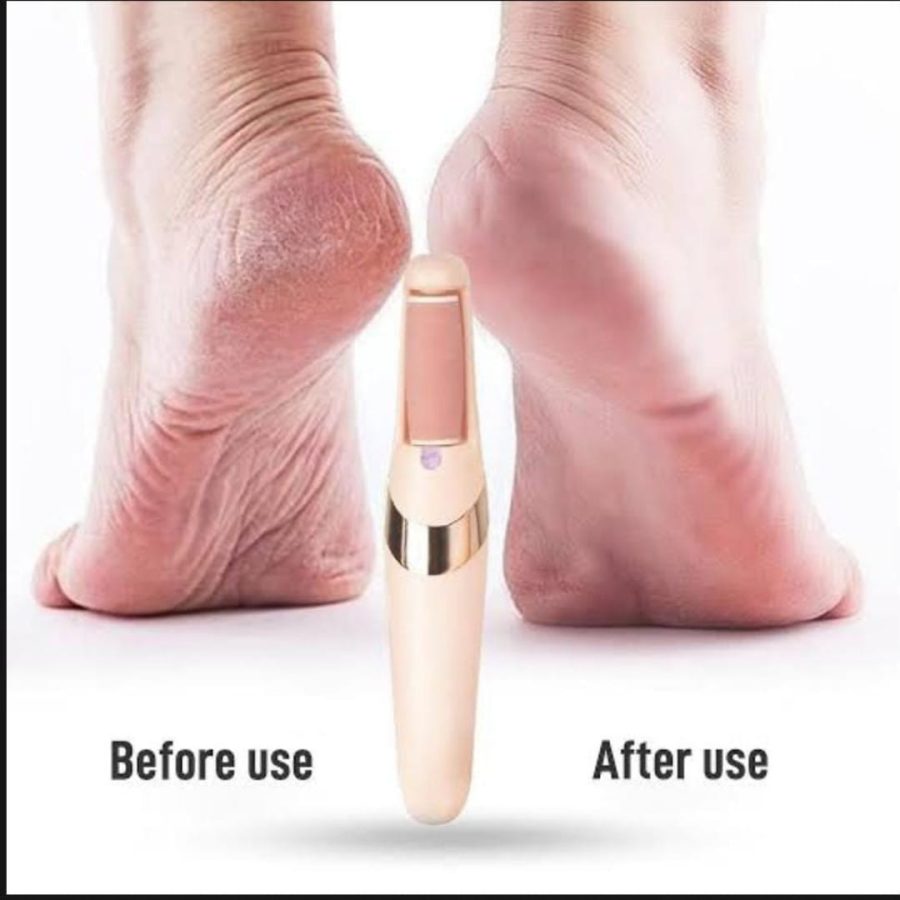 Rechargeable Electric Foot File Callus Remover — photo 3